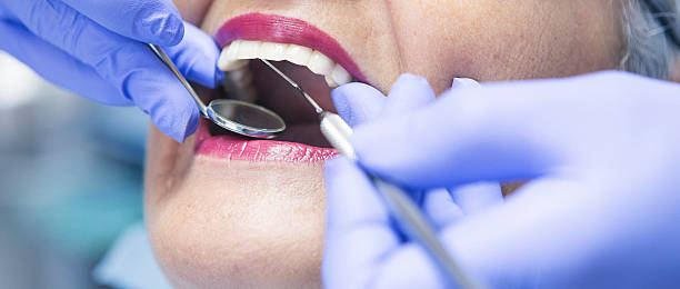 Best Emergency Root Canal Therapy in Huber Ridge, OH